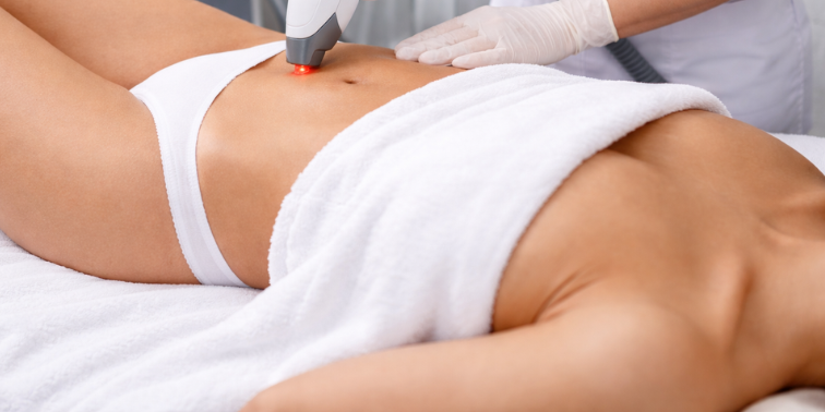 Нужна ли лазерная эпиляция зоны бикини?